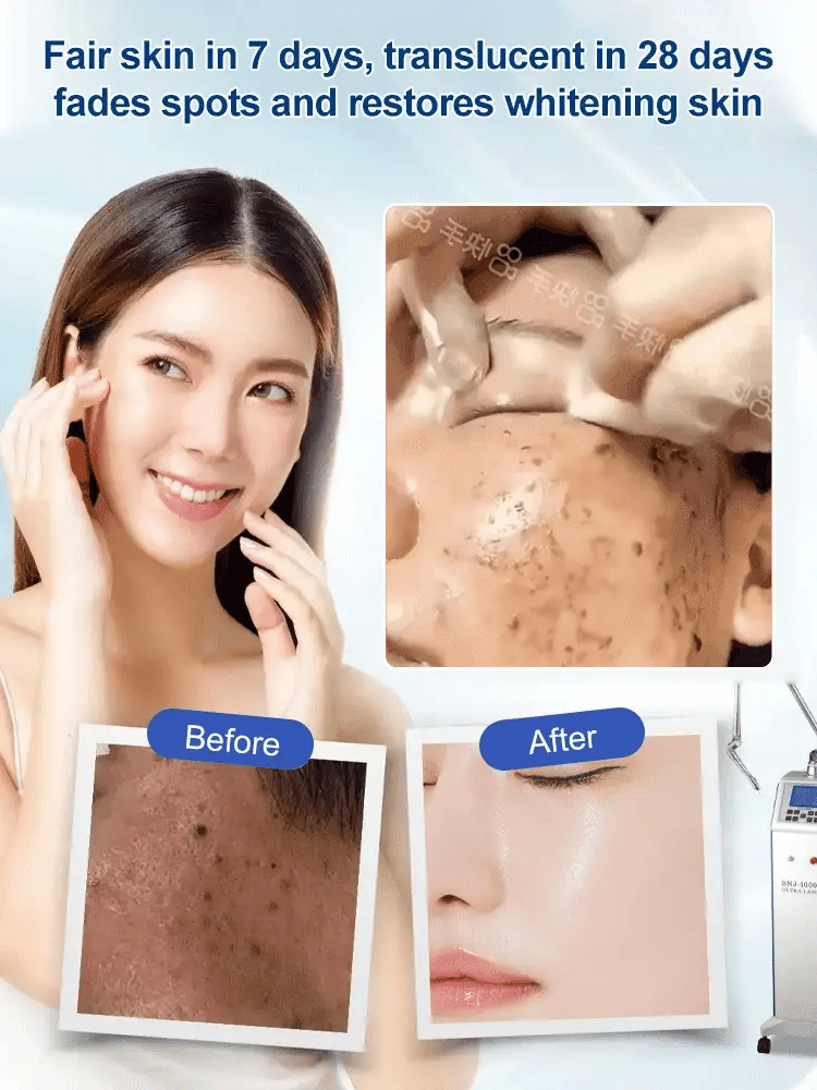 Spot Fading Urea Cream ( Buy 1 Get 1 )