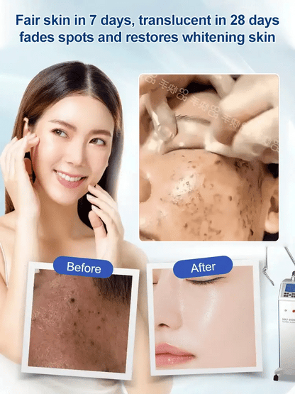 Spot Fading Urea Cream ( Buy 1 Get 1 )
