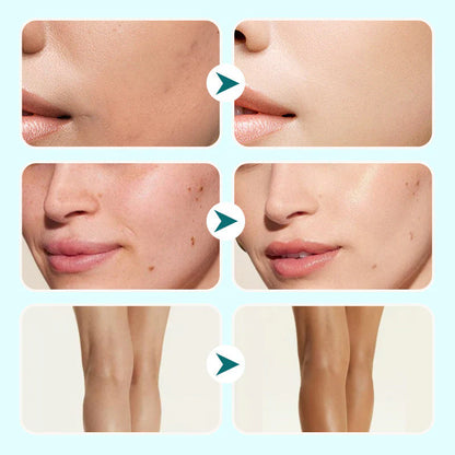 💜LAST DAY - BUY 1 GET 3 FREE💜All-in-One Moisturizing Concealer Waterproof Cream